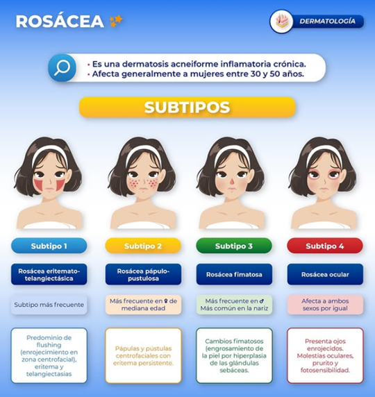 Rosacea